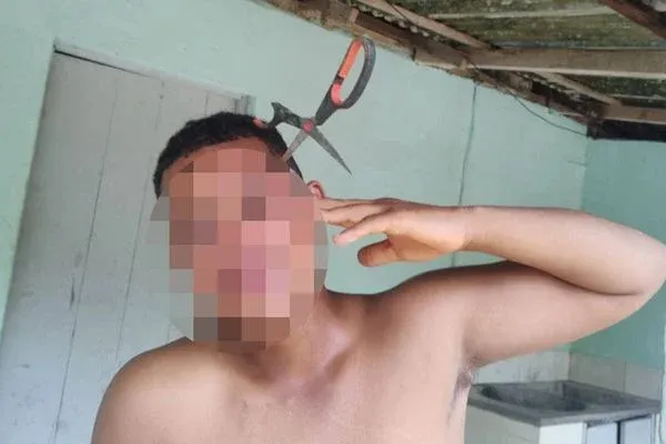 Menor vai separar briga de irmãs e acaba com tesoura cravada na cabeça na cidade de Pancas